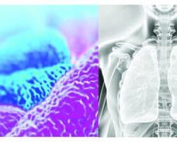 Legionella Prevention NSI